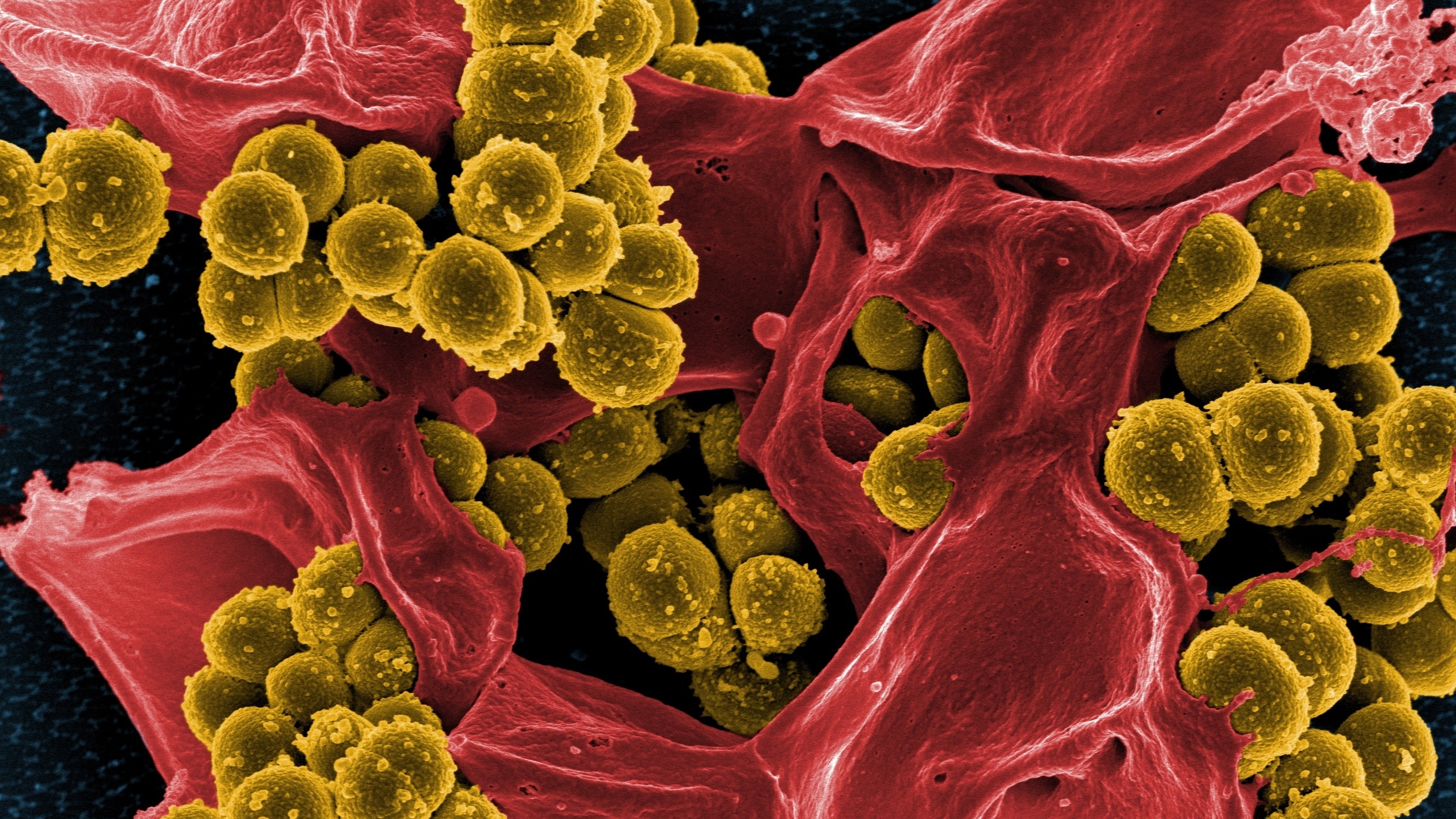 По всему миру бактерии выработали устойчивость к ряду бесконтрольно применяемым антибиотикам