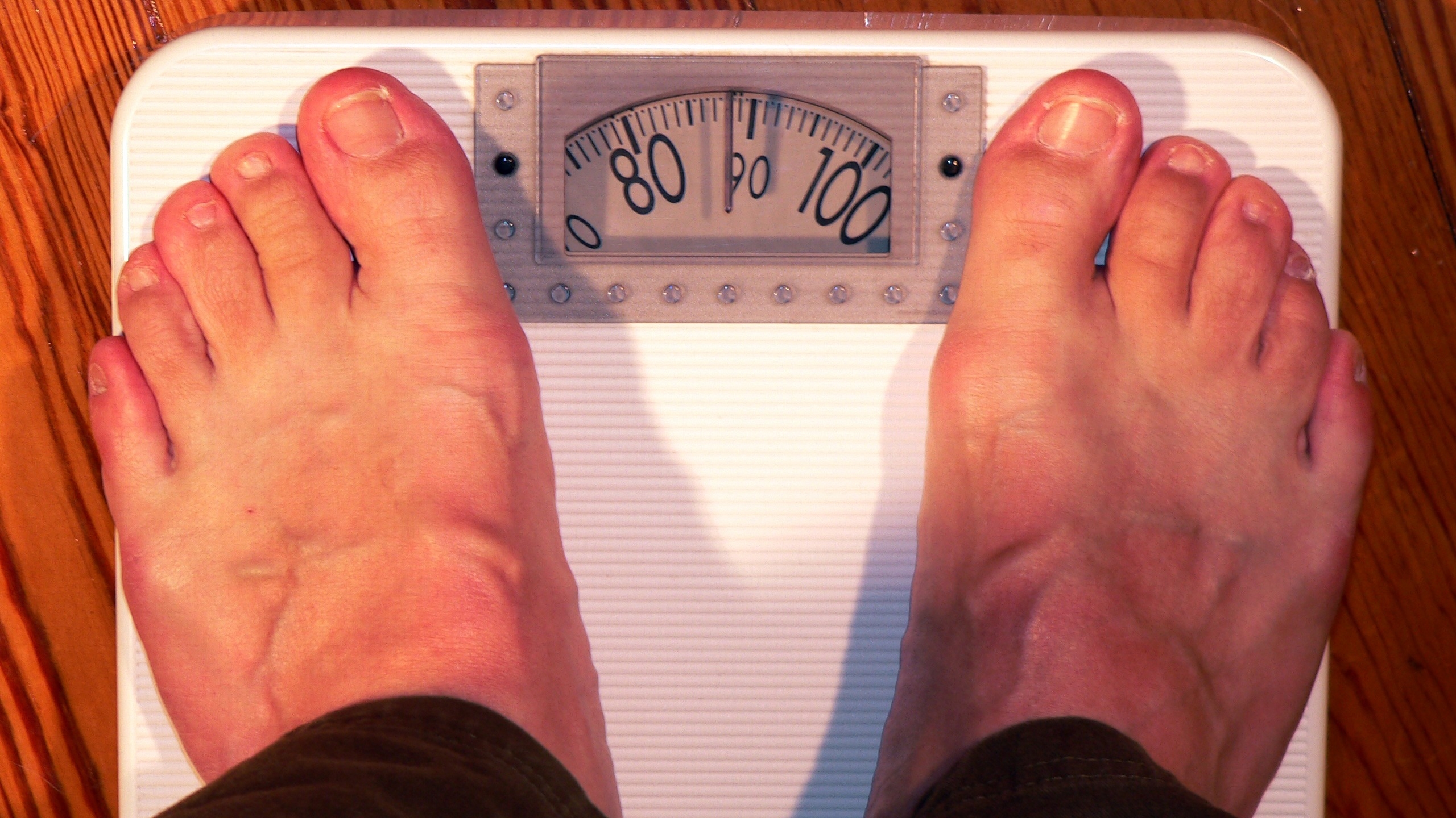 Онколог рассказал, какой вид рака чаще всего появляется у людей с лишним весом